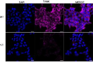 Immunocytochemical staining of HeLa cells using TANK antibody (ABIN7800580), 1:1,000), Top panel: wild-type (WT), Bottom panal: TANK shRNA knockdown (KD). (TANK Antikörper)