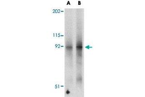 Western blot analysis of FNIP2 in mouse skeletal muscle tissue lysate with FNIP2 polyclonal antibody  at (A) 1 and (B) 2 ug/mL . (FNIP2 Antikörper  (N-Term))