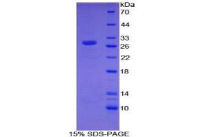 SDS-PAGE analysis of Mouse CHD3 Protein.