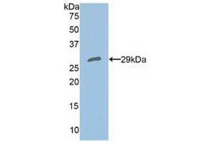 Detection of Recombinant PRDX4, Human using Polyclonal Antibody to Peroxiredoxin 4 (PRDX4) (Peroxiredoxin 4 Antikörper  (AA 6-249))