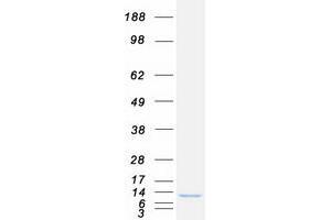 Western Blotting (WB) image for Dynein, Light Chain, Tctex-Type 1 (DYNLT1) protein (Myc-DYKDDDDK Tag) (ABIN2719883)