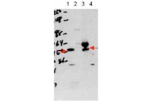 Image no. 1 for anti-Thyroid Hormone Receptor, alpha (THRA) (Isoform 1), (N-Term) antibody (ABIN401406) (THRA Antikörper  (Isoform 1, N-Term))