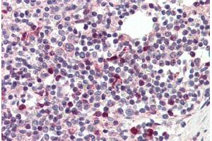 Human Spleen (formalin-fixed, paraffin-embedded) stained with TFEC antibody ABIN337184 at 5 ug/ml followed by biotinylated anti-goat IgG secondary antibody ABIN481715, alkaline phosphatase-streptavidin and chromogen. (TFEC Antikörper  (AA 217-228))
