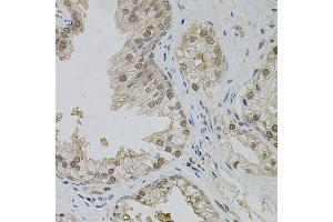 Immunohistochemistry of paraffin-embedded human prostate using MAPK1 antibody. (ERK2 Antikörper  (AA 200-300))