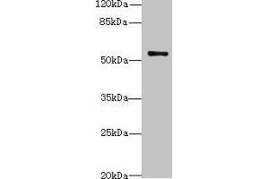 Western blot All lanes: TRIM38 antibody at 4 μg/mL + Jurkat whole cell lysate Secondary Goat polyclonal to rabbit IgG at 1/10000 dilution Predicted band size: 54 kDa Observed band size: 54 kDa (TRIM38 Antikörper  (AA 45-259))