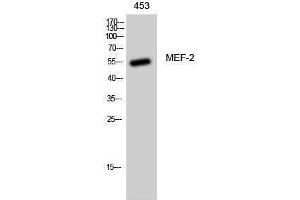 Western Blotting (WB) image for anti-Myelin Expression Factor 2 (MYEF2) (Ser89) antibody (ABIN3175957) (MYEF2 Antikörper  (Ser89))