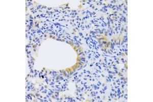 Immunohistochemistry of paraffin-embedded rat lung using MRPS30 Antibody (ABIN2563929) at dilution of 1:100 (40x lens).