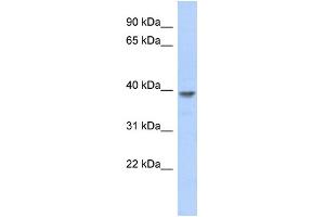WB Suggested Anti-MED8 Antibody Titration: 0. (MED8 Antikörper  (N-Term))