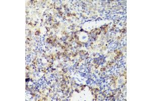 Immunohistochemistry of paraffin-embedded mouse spleen using IL18 antibody (ABIN7267992) at dilution of 1:50 (40x lens). (IL-18 Antikörper)
