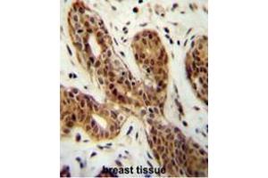 CI150 Antibody (N-term) immunohistochemistry analysis in formalin fixed and paraffin embedded human breast tissue followed by peroxidase conjugation of the secondary antibody and DAB staining. (CI150 Antikörper  (N-Term))