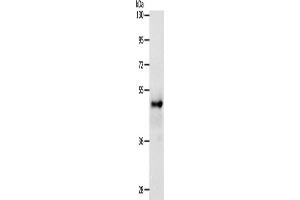 Western Blotting (WB) image for anti-SRY (Sex Determining Region Y)-Box 8 (SOX8) antibody (ABIN2426907) (SOX8 Antikörper)