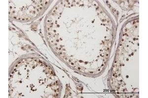 Image no. 1 for anti-Checkpoint Kinase 2 (CHEK2) (AA 1-544) antibody (ABIN599174) (CHEK2 Antikörper  (AA 1-544))
