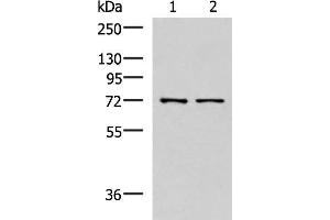 Western blot analysis of Mouse liver tissue and Jurkat cell lysates using MKS1 Polyclonal Antibody at dilution of 1:700 (MKS1 Antikörper)