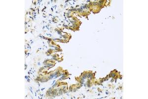 Immunohistochemistry of paraffin-embedded mouse lung using DEFB4A antibody (ABIN5974965) at dilution of 1/100 (40x lens). (DEFB4A Antikörper)
