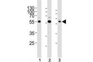 Western blot analysis of lysate from human (1) Jurkat, (2) PC3, and rat (3) C6 cells using AKT1/2/3 antibody at 1:1000. (AKT 1/2/3 Antikörper  (AA 278-312))