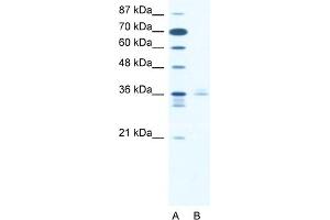 WB Suggested Anti-LHX3 Antibody   Titration: 2. (LHX3 Antikörper  (Middle Region))