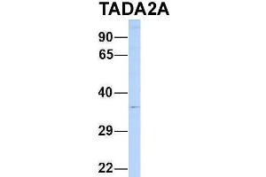 Host:  Rabbit  Target Name:  TADA2A  Sample Type:  721_B  Antibody Dilution:  1. (TADA2L Antikörper  (N-Term))