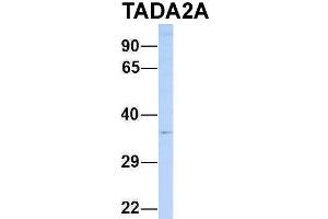 Host:  Rabbit  Target Name:  TADA2A  Sample Type:  721_B  Antibody Dilution:  1.
