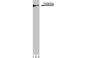 Western blot analysis of MAP1B on a mouse fetus head lysate.