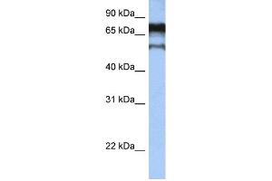 WB Suggested Anti-ZNF780B Antibody Titration:  0. (ZNF780B Antikörper  (N-Term))