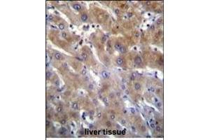 ANKRD18B Antibody (N-term) (ABIN655769 and ABIN2845209) immunohistochemistry analysis in formalin fixed and paraffin embedded human liver tissue followed by peroxidase conjugation of the secondary antibody and DAB staining. (ANKRD18B Antikörper  (N-Term))