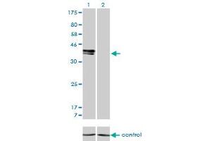 Western blot analysis of ISL1 over-expressed 293 cell line, cotransfected with ISL1 Validated Chimera RNAi (Lane 2) or non-transfected control (Lane 1). (ISL1 Antikörper  (AA 63-159))
