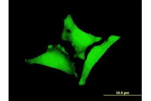 Immunofluorescence of monoclonal antibody to WBP1 on HeLa cell.