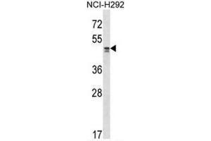 TADA2L Antibody (Center) western blot analysis in NCI-H292 cell line lysates (35µg/lane). (TADA2L Antikörper  (Middle Region))