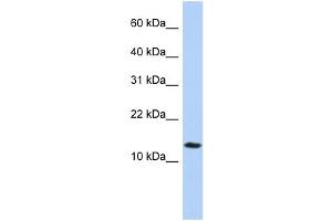 WB Suggested Anti-FAM14A Antibody Titration:  0. (IFI27L2 Antikörper  (Middle Region))