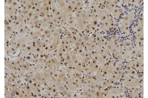 ABIN6277489 at 1/100 staining Human liver tissue by IHC-P. (FAM160B2 Antikörper  (Internal Region))