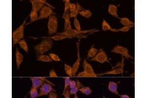 Immunofluorescence analysis of HeLa cells using USP15 Polyclonal Antibody at dilution of 1:100 (40x lens). (USP15 Antikörper)