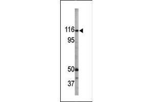 Image no. 1 for anti-Retinoblastoma-Like 1 (p107) (RBL1) (pSer975) antibody (ABIN358209) (p107 Antikörper  (pSer975))