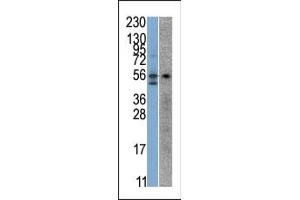 The anti-STK38 Pab (ABIN391097 and ABIN2841236) is used in Western blot to detect STK38 in SK-Br-3 (left) and Jurkat (right) cell line lysates. (STK38 Antikörper  (C-Term))