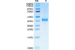 Biotinylated Cynomolgus IL-2 R beta on Tris-Bis PAGE under reduced condition. (IL2 Receptor beta Protein (AA 27-239) (His tag,Biotin))