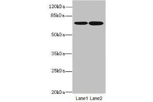 Western blot All lanes: SLC23A2antibody at 3. (SLC23A2 Antikörper  (AA 1-90))