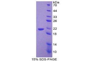 SDS-PAGE (SDS) image for Corticotropin Releasing Hormone (CRH) (AA 40-195) protein (His tag) (ABIN2124510) (CRH Protein (AA 40-195) (His tag))