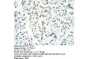 Rabbit Anti-SFPQ Antibody  Paraffin Embedded Tissue: Human Muscle Cellular Data: Skeletal muscle cells Antibody Concentration: 4. (SFPQ Antikörper  (Middle Region))