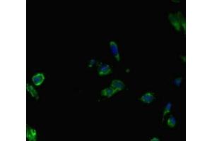 Immunofluorescent analysis of Hela cells using ABIN7145087 at dilution of 1:100 and Alexa Fluor 488-congugated AffiniPure Goat Anti-Rabbit IgG(H+L) (AIRE Antikörper  (AA 39-108))