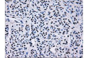 Image no. 11 for anti-Replication Protein A2, 32kDa (RPA2) antibody (ABIN1500735)