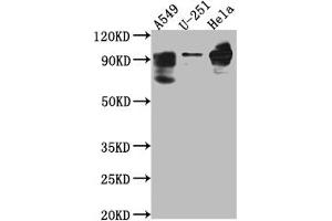 Western Blot Positive WB detected in: THP-1 whole cell lysate All lanes: PDE4D antibody at 1:1000 Secondary Goat polyclonal to rabbit IgG at 1/50000 dilution Predicted band size: 92, 77, 69, 67, 58, 85, 24, 60, 78, 77, 85, 25 kDa Observed band size: 92 kDa (Rekombinanter PDE4D Antikörper)