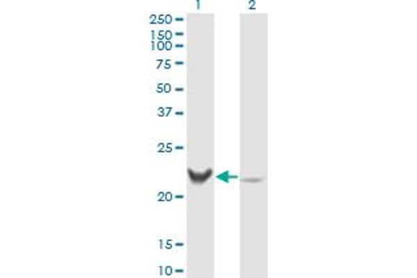 Recoverin Antikörper  (AA 101-199)