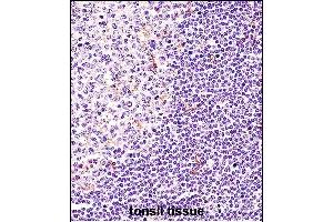 BTK Antibody (N-term) (ABIN657469 and ABIN2846497) immunohistochemistry analysis in formalin fixed and paraffin embedded human tonsil tissue followed by peroxidase conjugation of the secondary antibody and DAB staining. (BTK Antikörper  (N-Term))