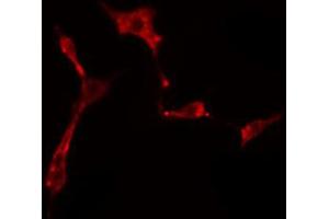 ABIN6274500 staining HeLa cells by IF/ICC.
