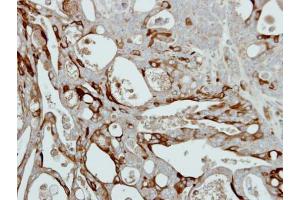 IHC-P Image Immunohistochemical analysis of paraffin-embedded NCIN87 xenograft, using Collagen III alpha1, antibody at 1:500 dilution. (COL3A1 Antikörper  (C-Term))