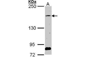 WB Image Sample (30 ug of whole cell lysate) A: A549 5% SDS PAGE antibody diluted at 1:1000 (SOS2 Antikörper  (Center))