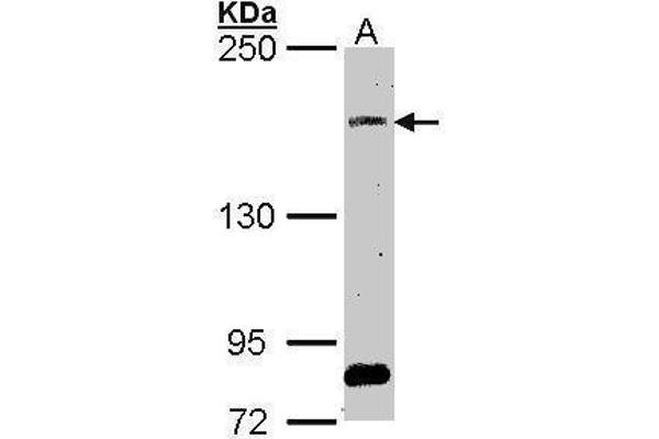 SOS2 anticorps  (Center)