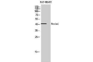 Western Blotting (WB) image for anti-Hexamethylene Bis-Acetamide Inducible 1 (HEXIM1) (Internal Region) antibody (ABIN3175479) (HEXIM1 Antikörper  (Internal Region))