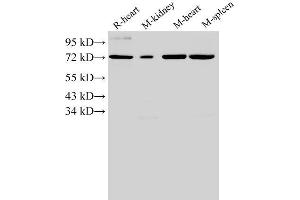 Western Blotting (WB) image for anti-Annexin A6 (ANXA6) antibody (ABIN7234042) (ANXA6 Antikörper)
