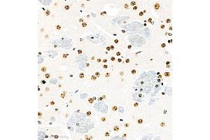 Immunohistochemistry (Paraffin-embedded Sections) (IHC (p)) image for anti-Ubiquitin Specific Peptidase 18 (USP18) antibody (ABIN7076108)