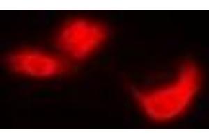 Immunofluorescent analysis of EIF6 staining in Hela cells. (EIF6 Antikörper)
